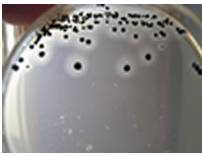 伊红美蓝鉴别大肠杆菌颜色变化-涨知识｜常见微生物菌落形态图及比较