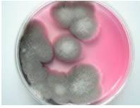 伊红美蓝鉴别大肠杆菌颜色变化_伊红美蓝鉴别大肠杆菌颜色变化_大肠杆菌在伊红美蓝上颜色