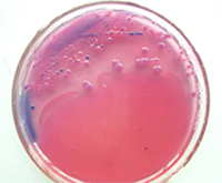伊红美蓝鉴别大肠杆菌颜色变化_大肠杆菌在伊红美蓝上颜色_伊红美蓝鉴别大肠杆菌颜色变化