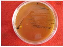 伊红美蓝鉴别大肠杆菌颜色变化_大肠杆菌在伊红美蓝上颜色_伊红美蓝鉴别大肠杆菌颜色变化