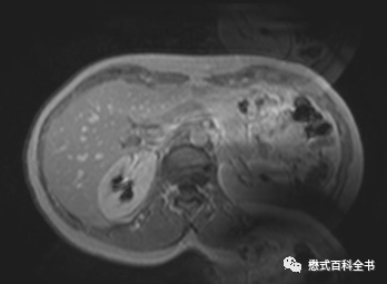 硬件系统五大组成部分_硬件系统最核心的部件_硬件系统