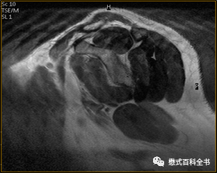 硬件系统五大组成部分_硬件系统_硬件系统最核心的部件