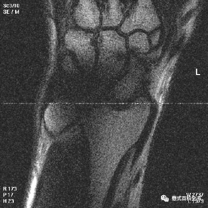 硬件系统最核心的部件_硬件系统_硬件系统五大组成部分