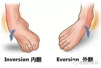 扶他林软膏-临床医生说科普丨“崴脚”了该怎么办？